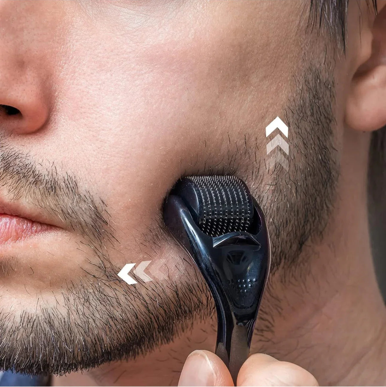 Titanium Facial Dermaroller 0.5 mm | Microneedling for Radiant Skin - shovota